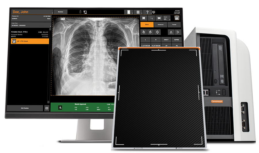 DRX-1 Console Display Plus Detector